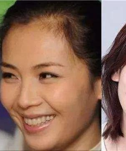 世界品牌陶瓷牙排名：世界品牌陶瓷牙排名前十